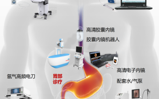 消化科技能 微创减重新时代！消化介入“黑科技“无创解决肥胖困扰